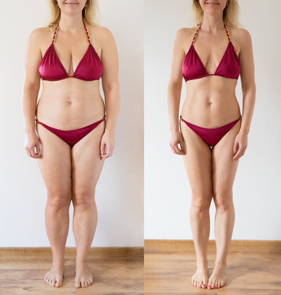 Real,Photo,Of,Woman,Before,And,After,Weight,Loss