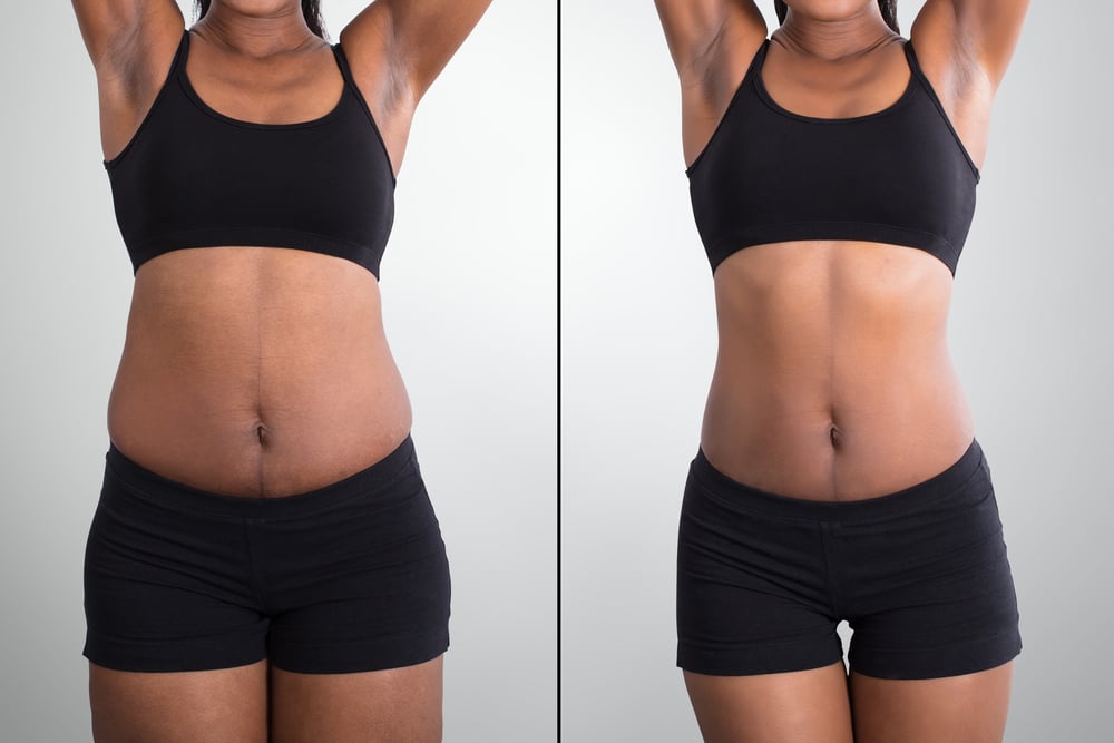 Before,And,After,Concept,Showing,Fat,To,Slim,African,Woman